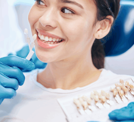 Dental Veneers