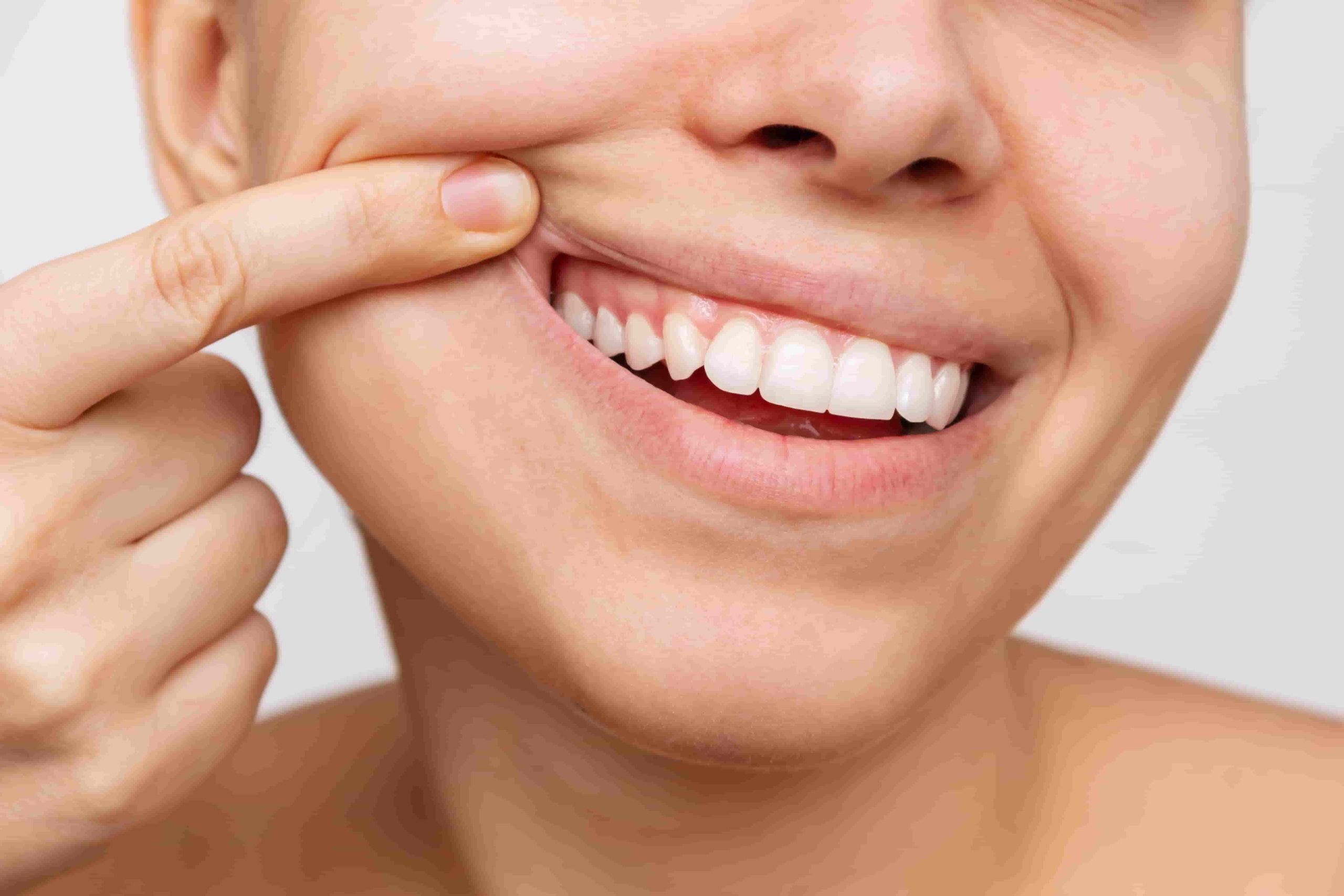 The Importance of Healthy Gums
